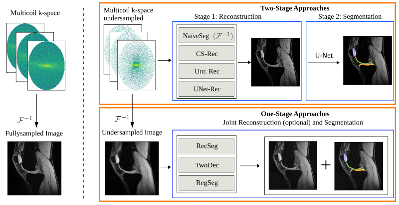 Understanding Benefits and Pitfalls of Current Methods for the Segmentation of Undersampled MRI Data